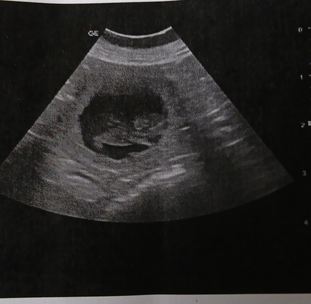 Naissance attendue fin septembre